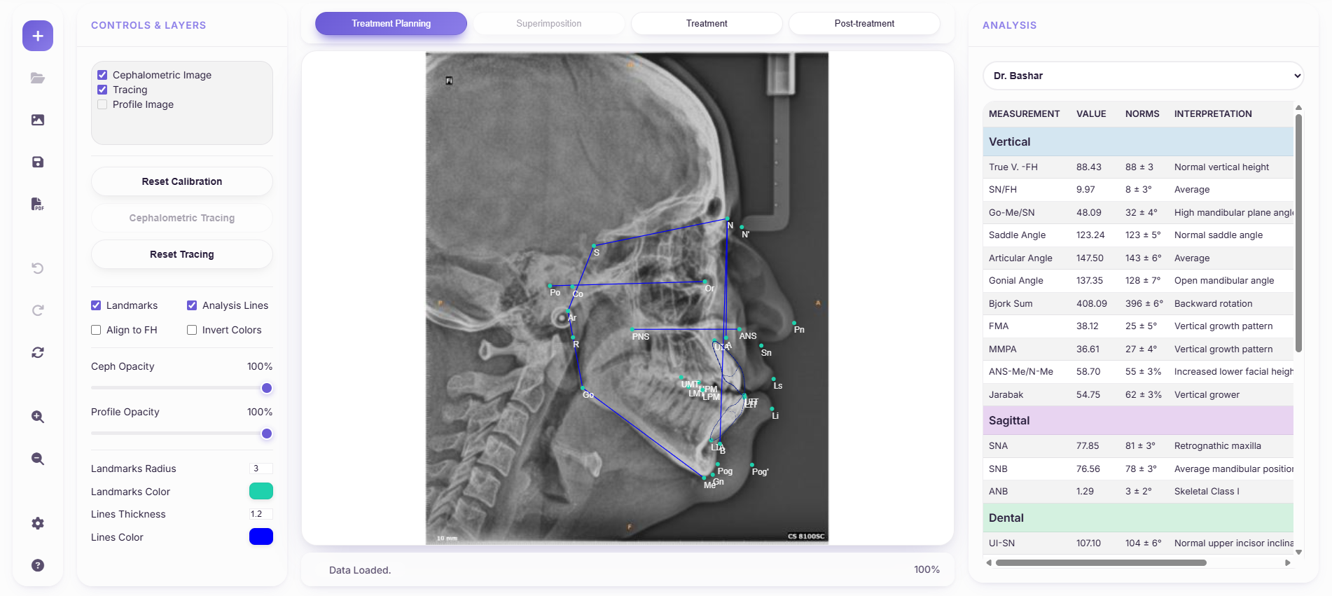 Cephalometric analysis interface preview